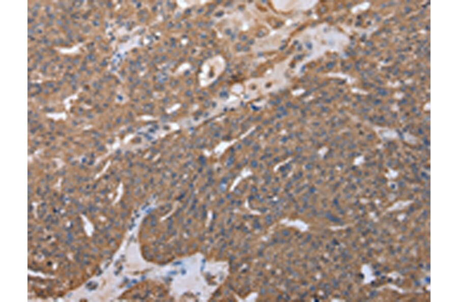 Immunohistochemistry - RARS Antibody from Signalway Antibody (43054) - Antibodies.com