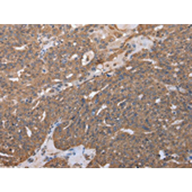 Immunohistochemistry - RARS Antibody from Signalway Antibody (43054) - Antibodies.com