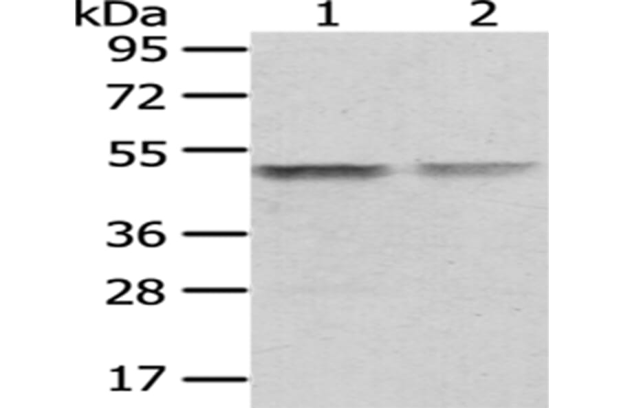 TUFM Antibody from Signalway Antibody (43059) - Antibodies.com