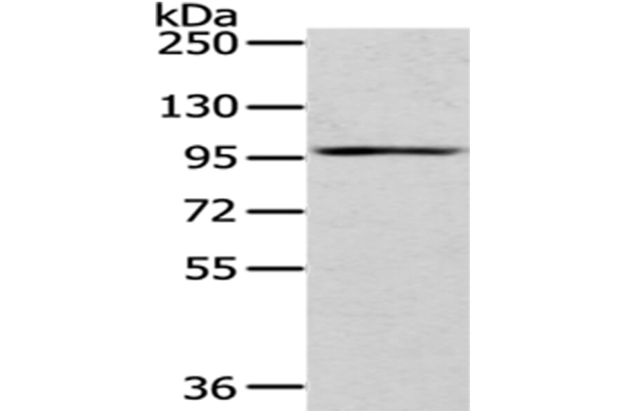 H6PD Antibody from Signalway Antibody (43061) - Antibodies.com