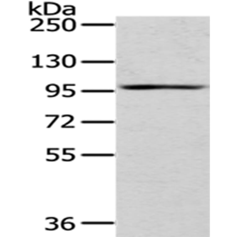 H6PD Antibody from Signalway Antibody (43061) - Antibodies.com