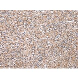 Immunohistochemistry - H6PD Antibody from Signalway Antibody (43061) - Antibodies.com