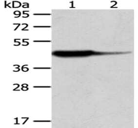 HAO1 Antibody from Signalway Antibody (43063) - Antibodies.com