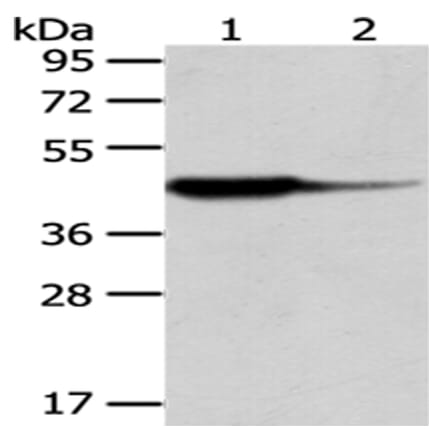 HAO1 Antibody from Signalway Antibody (43063) - Antibodies.com
