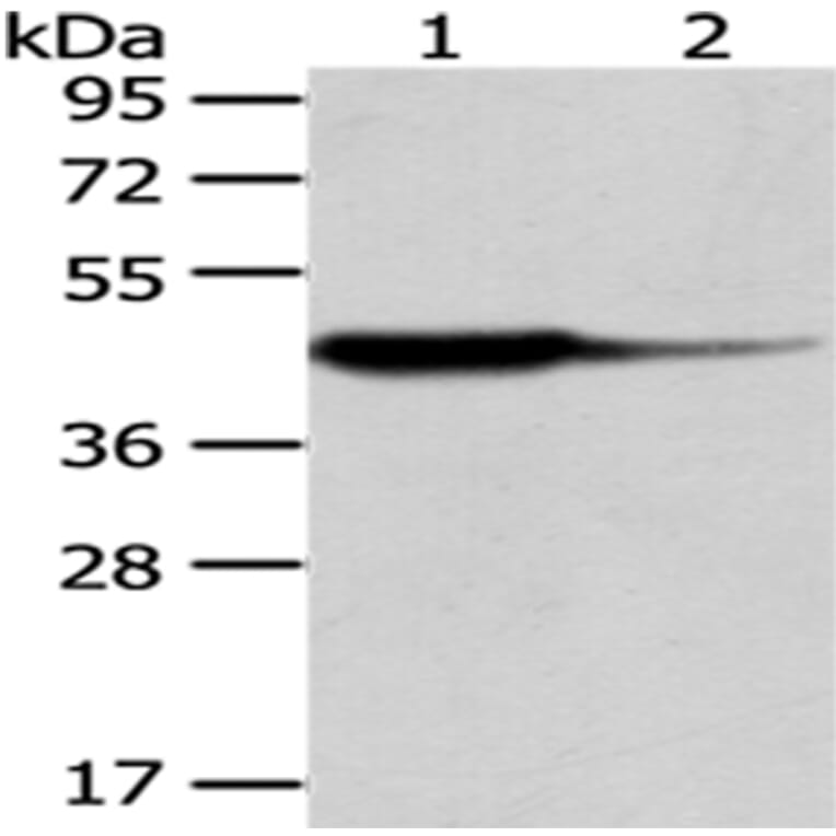 HAO1 Antibody from Signalway Antibody (43063) - Antibodies.com