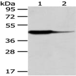 HAO1 Antibody from Signalway Antibody (43063) - Antibodies.com
