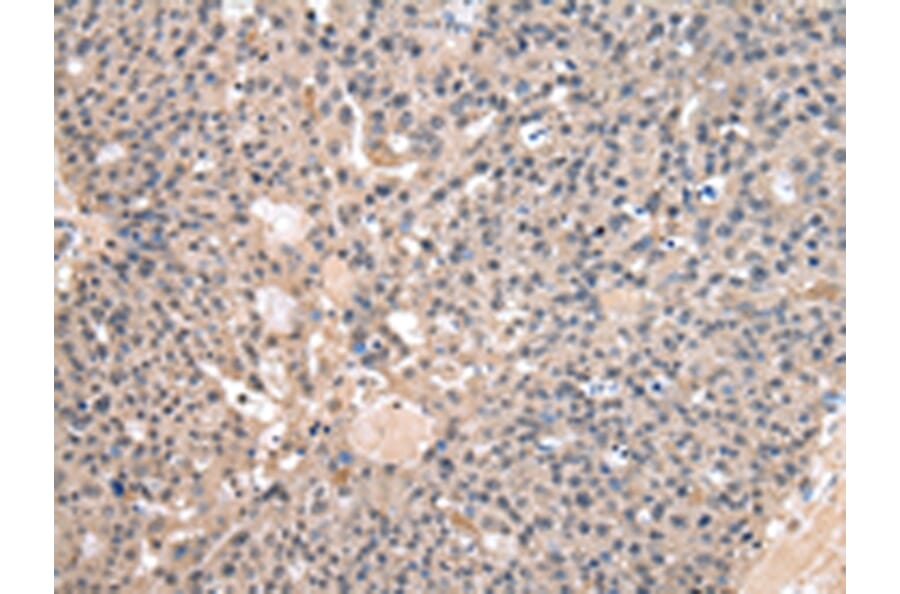 Immunohistochemistry - HAO1 Antibody from Signalway Antibody (43063) - Antibodies.com