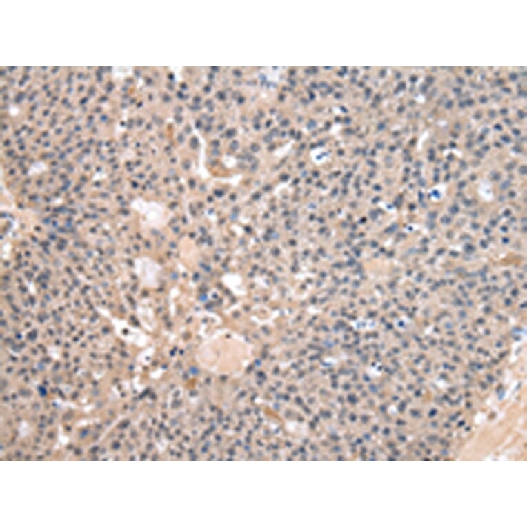 Immunohistochemistry - HAO1 Antibody from Signalway Antibody (43063) - Antibodies.com