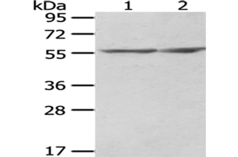 CCT2 Antibody from Signalway Antibody (43067) - Antibodies.com