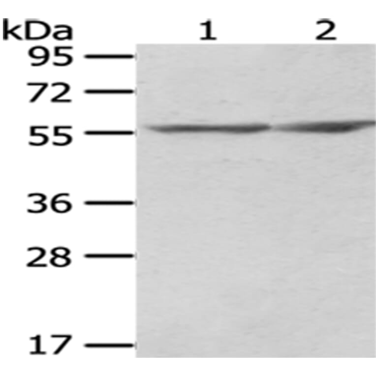CCT2 Antibody from Signalway Antibody (43067) - Antibodies.com