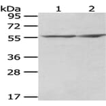 CCT2 Antibody from Signalway Antibody (43067) - Antibodies.com