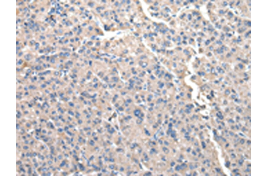 Immunohistochemistry - CCT2 Antibody from Signalway Antibody (43067) - Antibodies.com