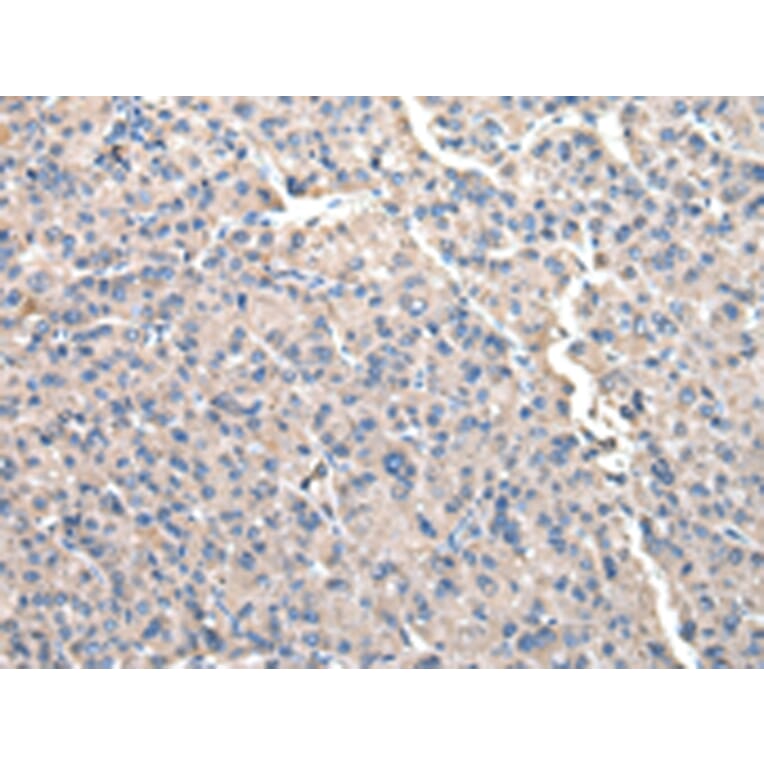 Immunohistochemistry - CCT2 Antibody from Signalway Antibody (43067) - Antibodies.com