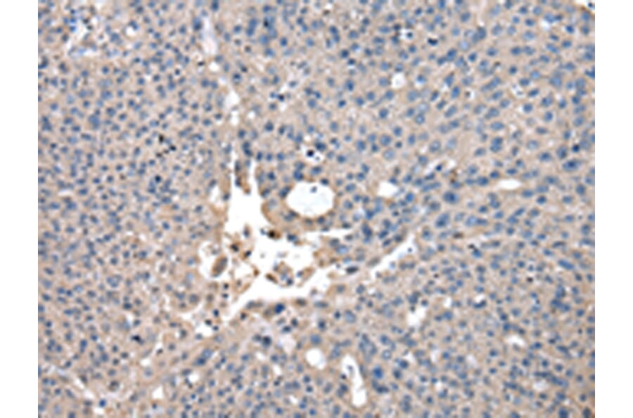 Immunohistochemistry - CCT2 Antibody from Signalway Antibody (43067) - Antibodies.com