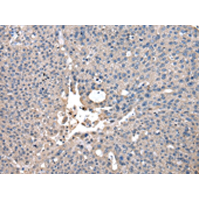 Immunohistochemistry - CCT2 Antibody from Signalway Antibody (43067) - Antibodies.com