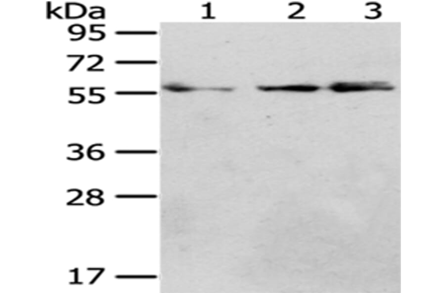 CCT4 Antibody from Signalway Antibody (43068) - Antibodies.com