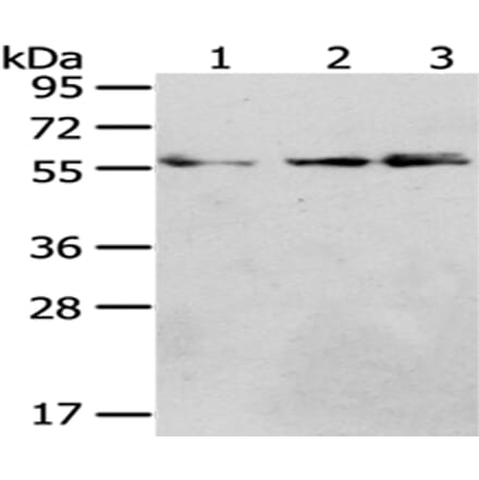 CCT4 Antibody from Signalway Antibody (43068) - Antibodies.com