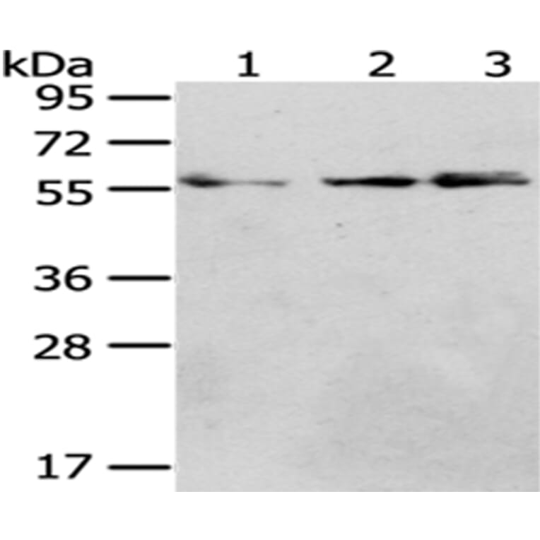 CCT4 Antibody from Signalway Antibody (43068) - Antibodies.com