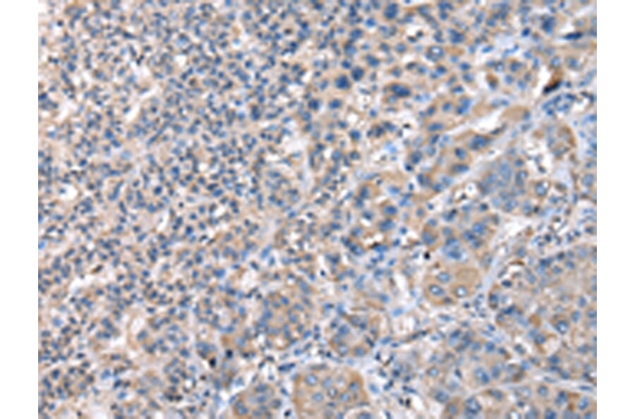 Immunohistochemistry - CCT4 Antibody from Signalway Antibody (43068) - Antibodies.com