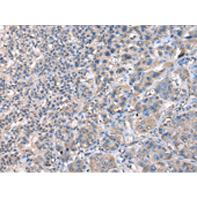 Immunohistochemistry - CCT4 Antibody from Signalway Antibody (43068) - Antibodies.com