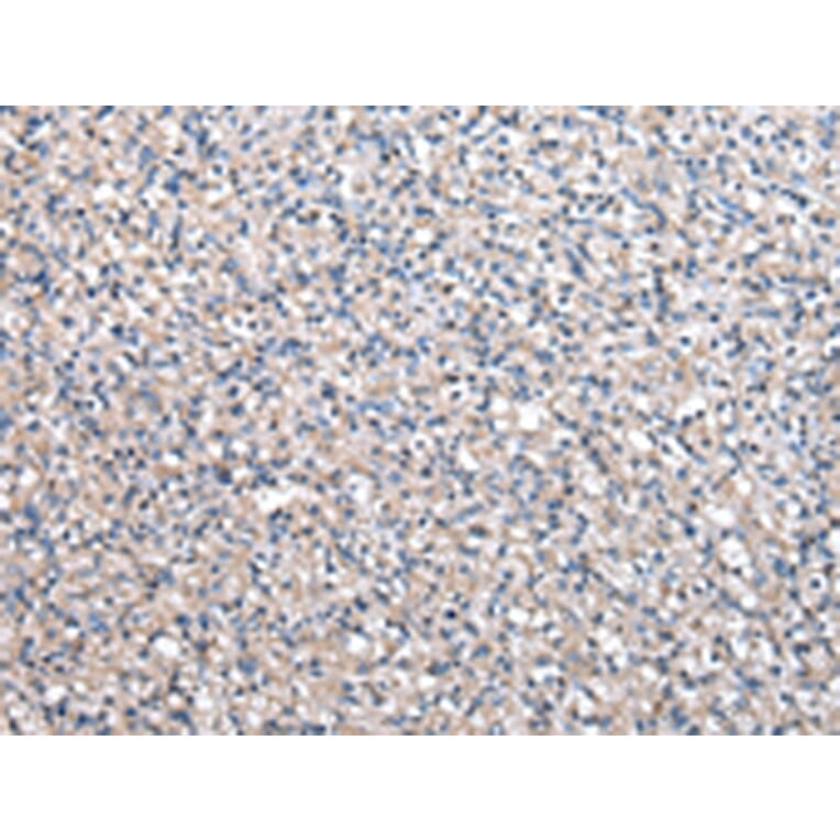 Immunohistochemistry - CCT4 Antibody from Signalway Antibody (43068) - Antibodies.com