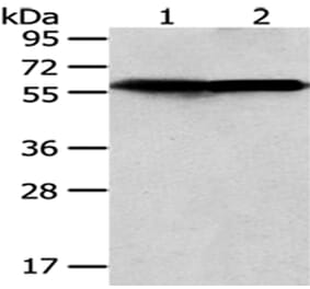 CCT5 Antibody from Signalway Antibody (43069) - Antibodies.com