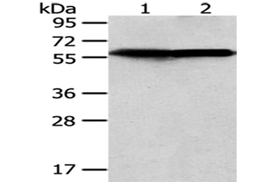 CCT5 Antibody from Signalway Antibody (43069) - Antibodies.com
