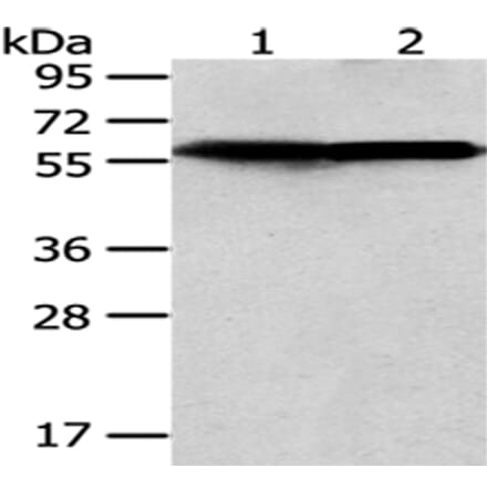 CCT5 Antibody from Signalway Antibody (43069) - Antibodies.com