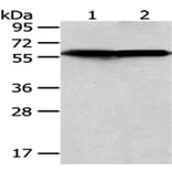 CCT5 Antibody from Signalway Antibody (43069) - Antibodies.com