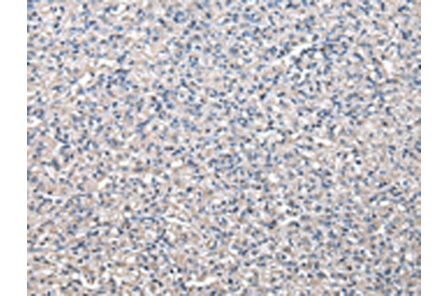 Immunohistochemistry - CCT5 Antibody from Signalway Antibody (43069) - Antibodies.com