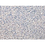 Immunohistochemistry - CCT5 Antibody from Signalway Antibody (43069) - Antibodies.com