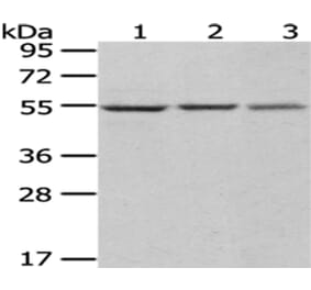 DARS Antibody from Signalway Antibody (43072) - Antibodies.com
