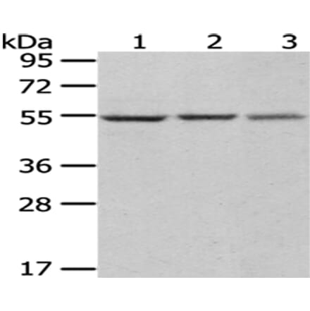 DARS Antibody from Signalway Antibody (43072) - Antibodies.com