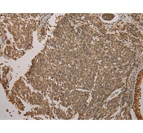 Immunohistochemistry - GALE Antibody from Signalway Antibody (43075) - Antibodies.com