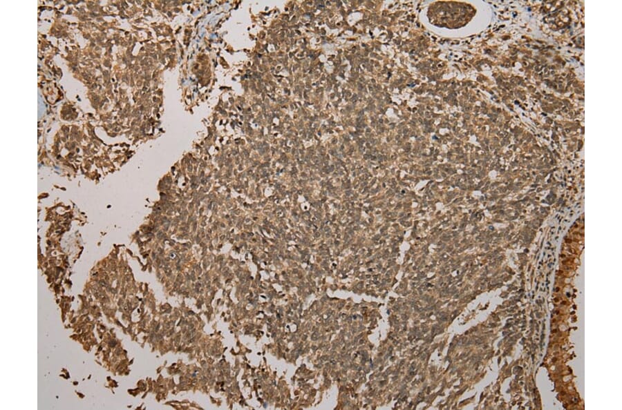Immunohistochemistry - GALE Antibody from Signalway Antibody (43075) - Antibodies.com