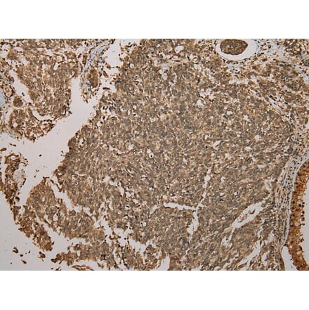 Immunohistochemistry - GALE Antibody from Signalway Antibody (43075) - Antibodies.com