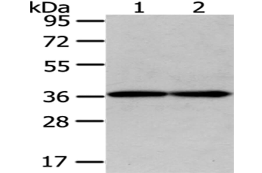 GALE Antibody from Signalway Antibody (43075) - Antibodies.com