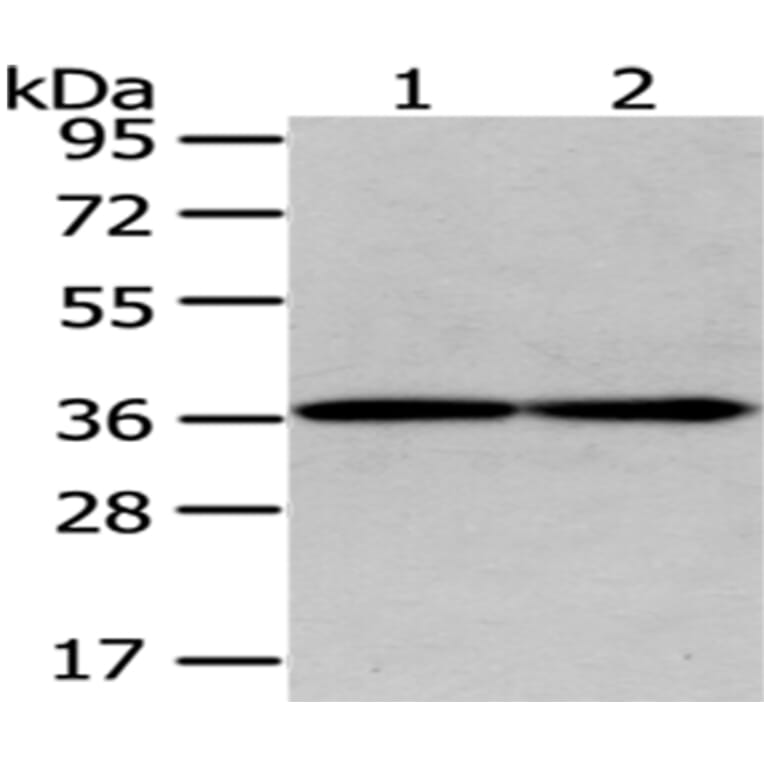 GALE Antibody from Signalway Antibody (43075) - Antibodies.com