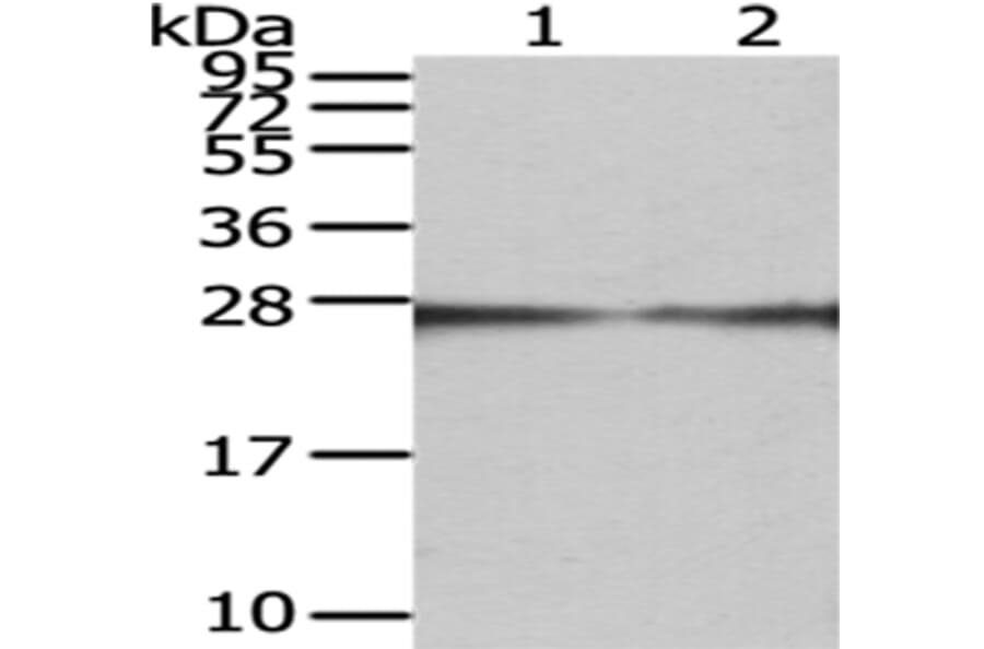 GAMT Antibody from Signalway Antibody (43076) - Antibodies.com