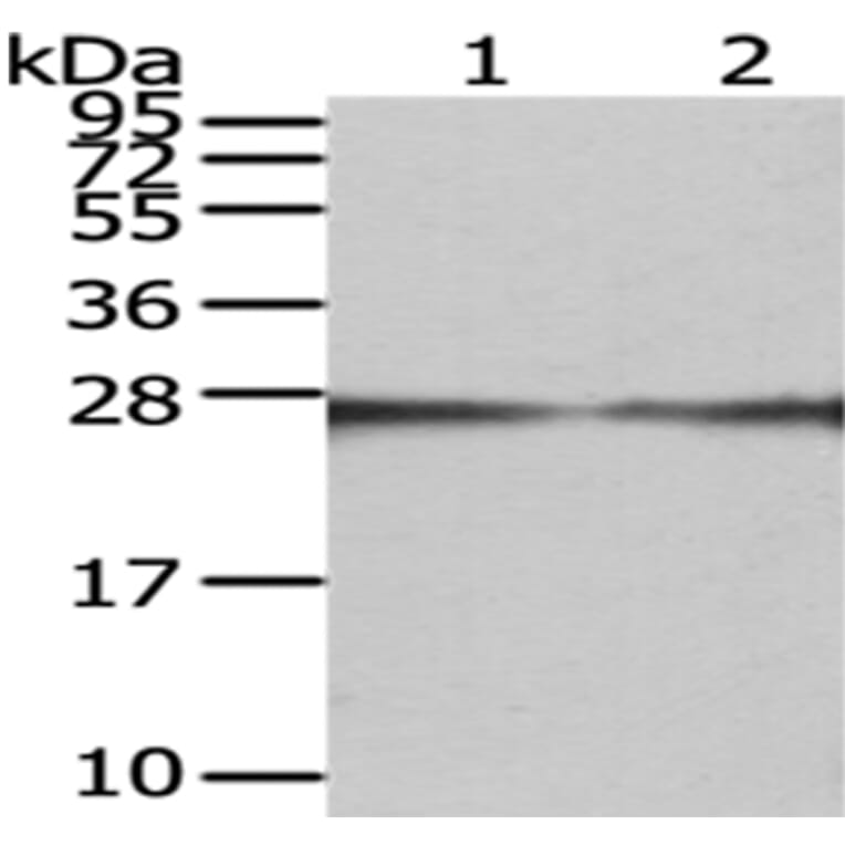 GAMT Antibody from Signalway Antibody (43076) - Antibodies.com