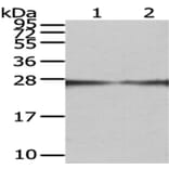 GAMT Antibody from Signalway Antibody (43076) - Antibodies.com