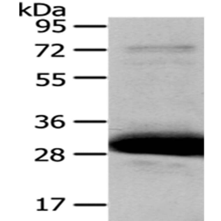 HAGH Antibody from Signalway Antibody (43077) - Antibodies.com
