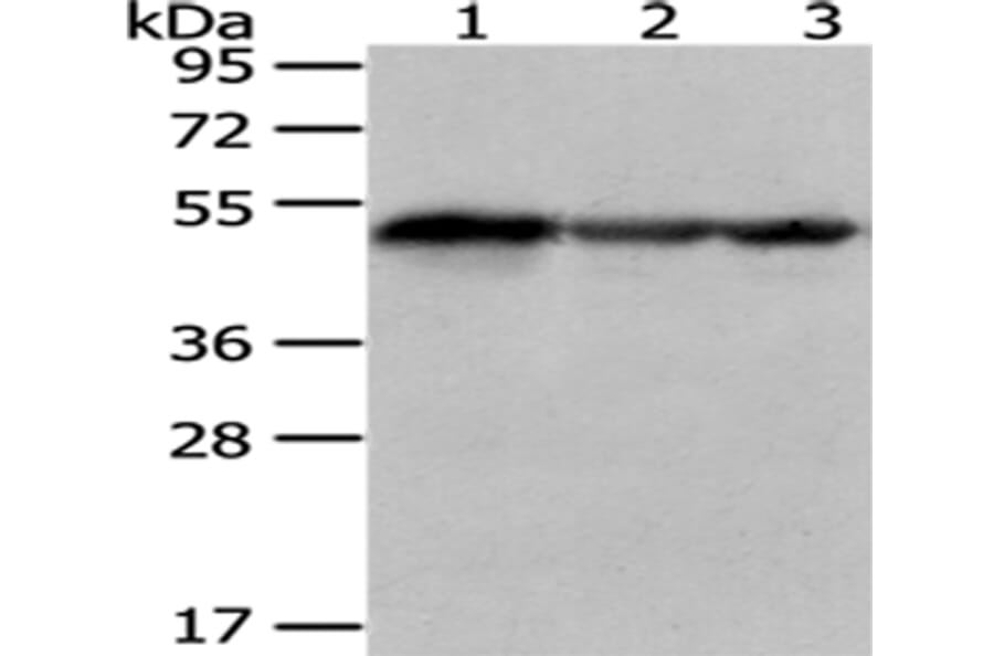 KYNU Antibody from Signalway Antibody (43079) - Antibodies.com