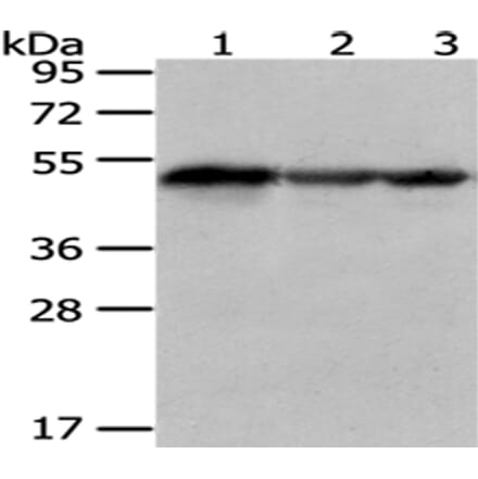 KYNU Antibody from Signalway Antibody (43079) - Antibodies.com