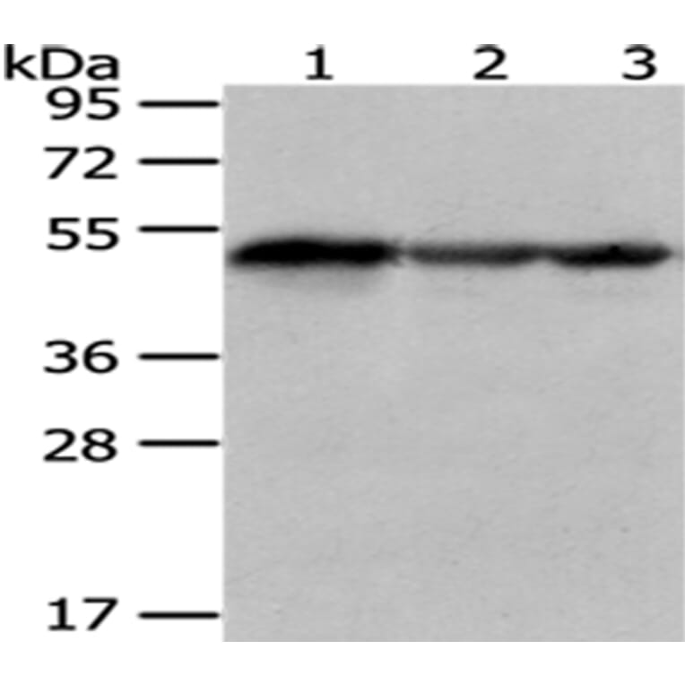 KYNU Antibody from Signalway Antibody (43079) - Antibodies.com