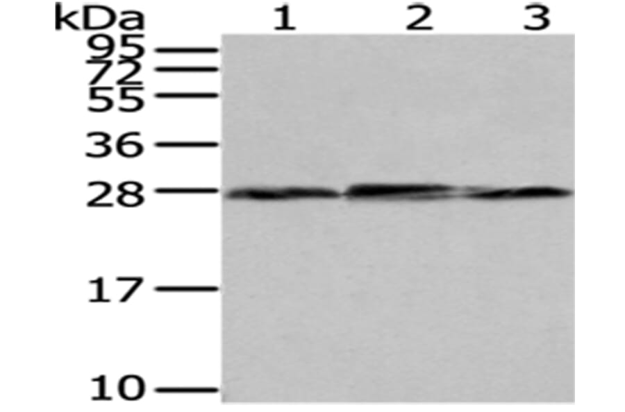 NNMT Antibody from Signalway Antibody (43081) - Antibodies.com