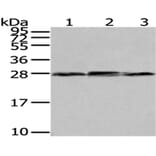 NNMT Antibody from Signalway Antibody (43081) - Antibodies.com