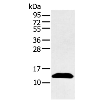 PPBP Antibody from Signalway Antibody (43092) - Antibodies.com