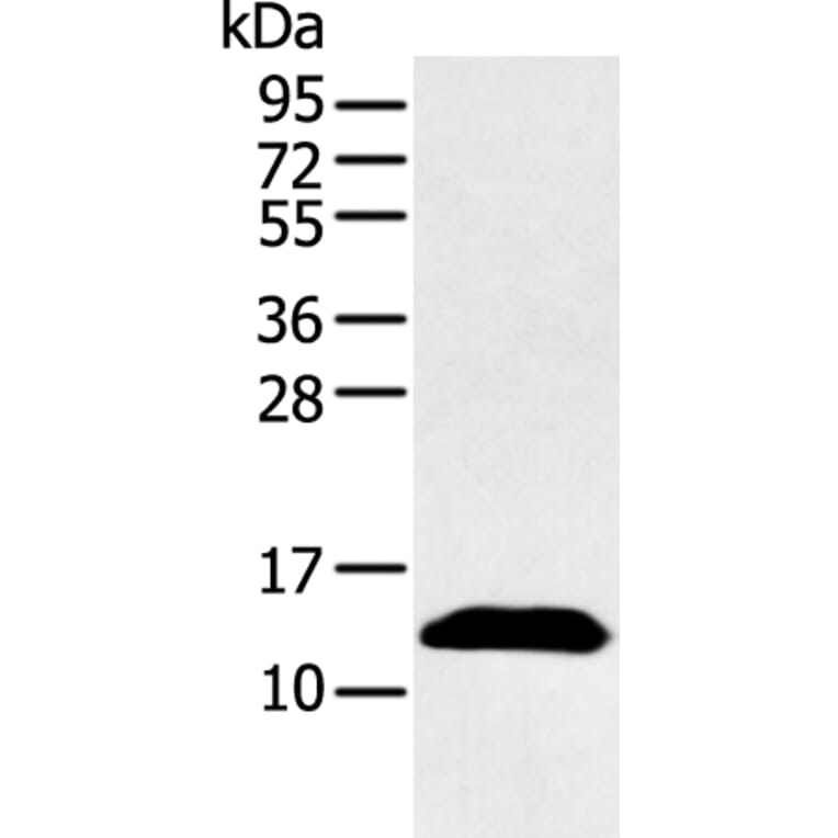 PPBP Antibody from Signalway Antibody (43092) - Antibodies.com