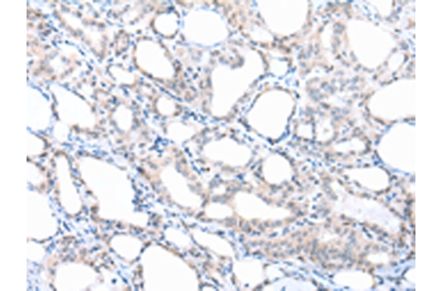 Immunohistochemistry - PPBP Antibody from Signalway Antibody (43092) - Antibodies.com